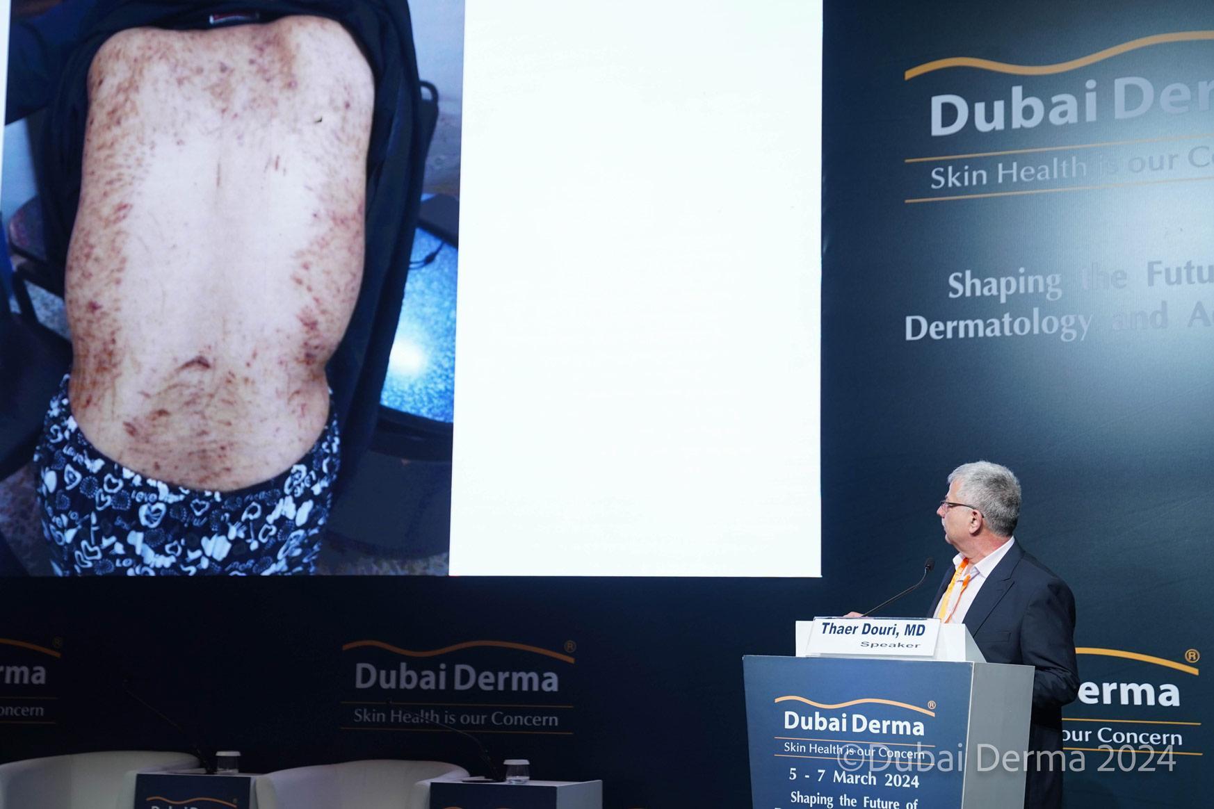 두바이 더마 국제 피부미용 및 레이저 컨퍼런스 전시회 2025 (Dubai Derma)
