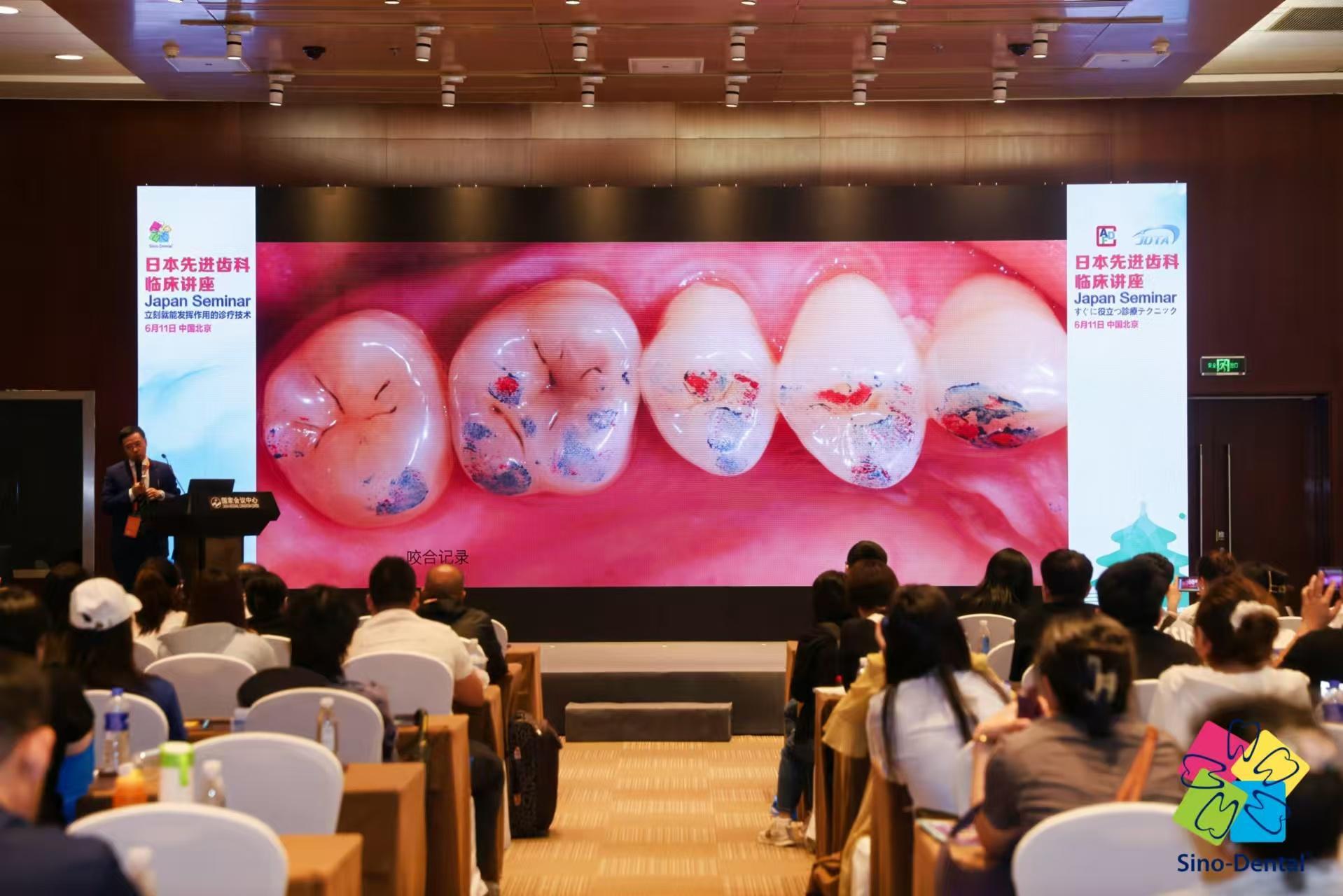 시노덴탈 - 중국 국제치과박람회 2025 (Sino Dental)